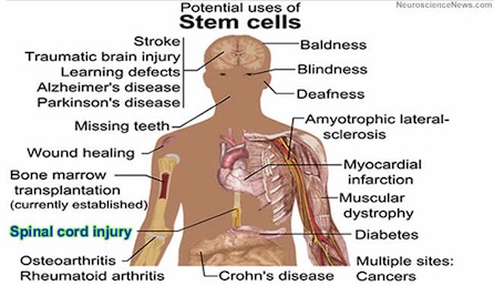 Possible Stem Cell Uses