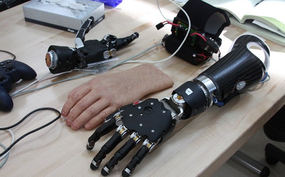 Bionic arm on a table beside the realistic prosthetic hand that will cover it