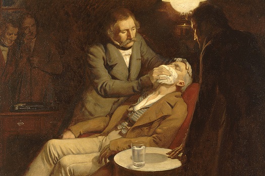 Oil painting of dentist W.T.G. Morton using an ether-soaked rag to anesthetize a patient by Ernest Board